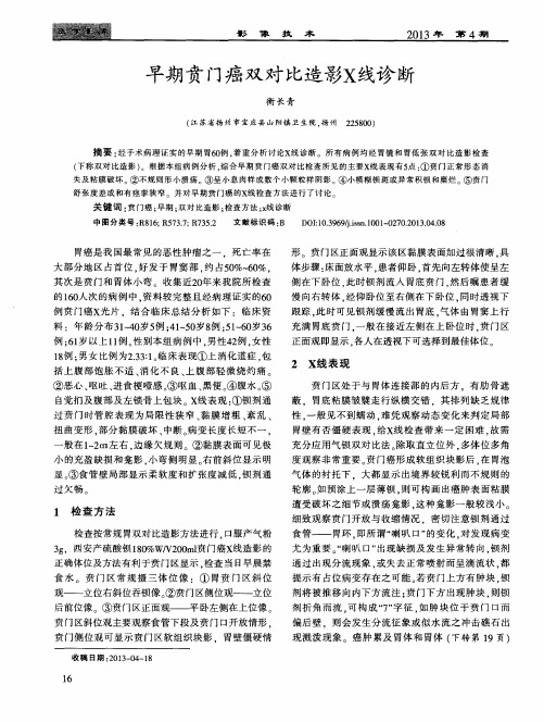 早期贲门癌双对比造影X线诊断