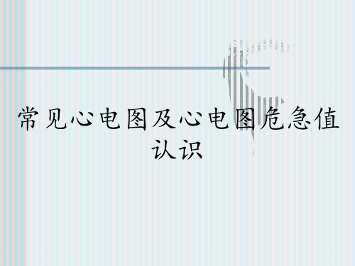 常见心电图及心电图危急值认识