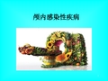 --颅内感染性疾病PPT课件