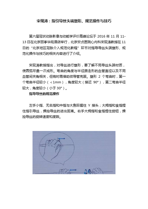 宋现涛：指引导丝头端塑形、规范操作与技巧