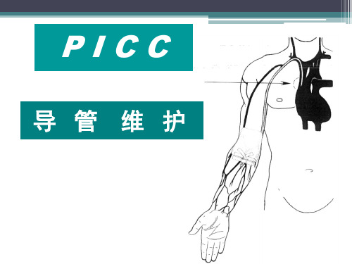 优质实用课件精选PICC导管维护