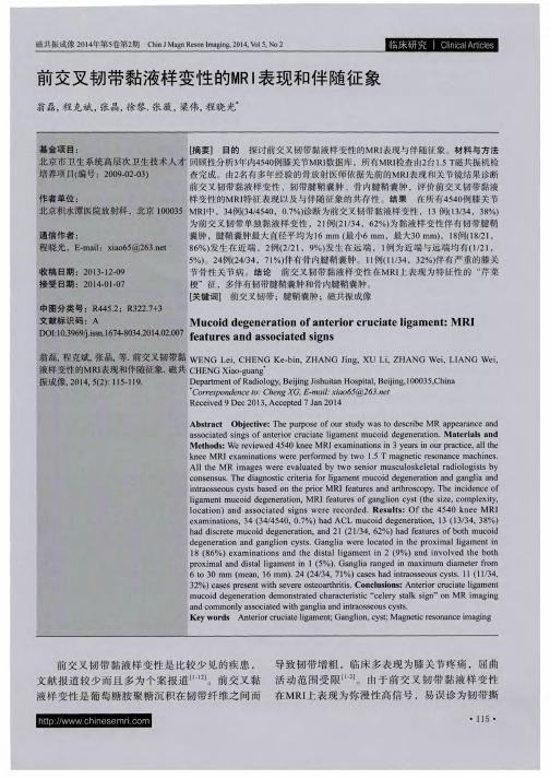 前交叉韧带黏液样变性的MRI表现和伴随征象