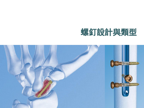 骨科基础-螺钉设计与类型