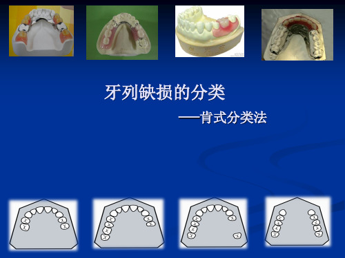肯式分类法