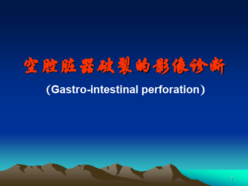 空腔脏器穿孔的影像诊断PPT课件