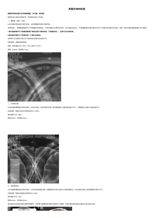 颅脑的MRI检查