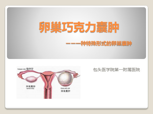 介入治疗卵巢囊肿