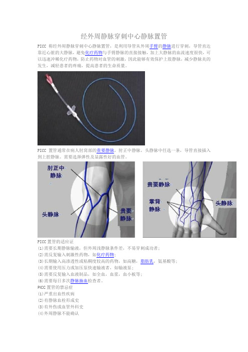 经外周静脉穿刺中心静脉置管