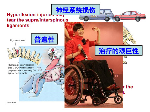 11 脑损伤修复与再生