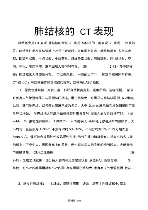 结核的CT表现