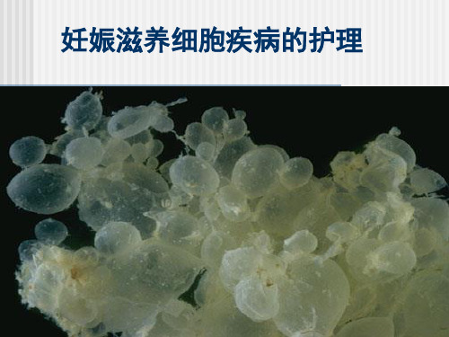 侵蚀葡萄胎