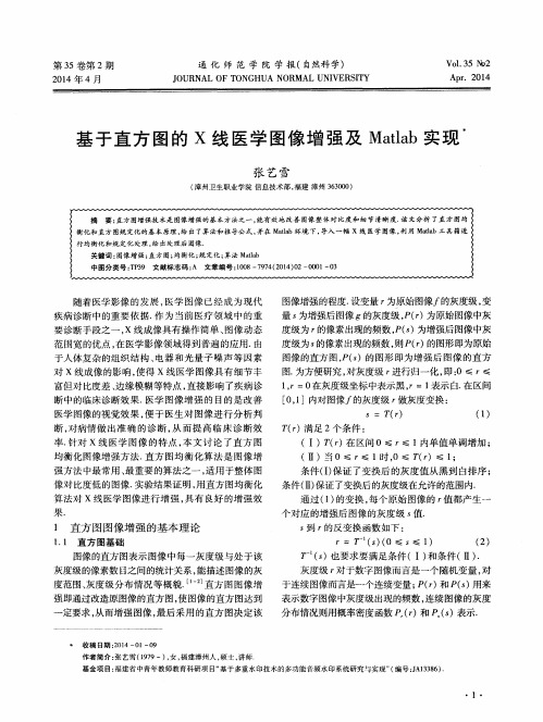 基于直方图的X线医学图像增强及Matlab实现