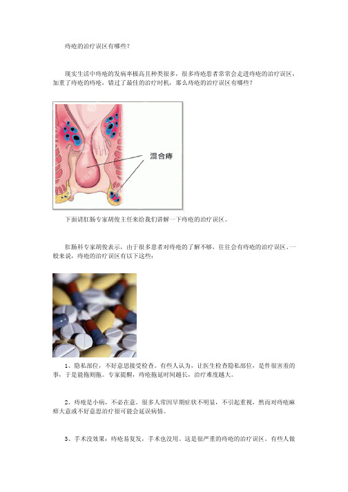 痔疮的治疗误区有哪些？