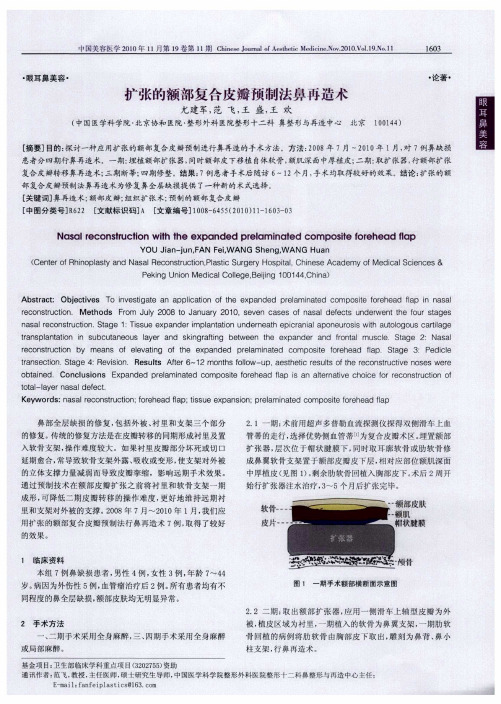 扩张的额部复合皮瓣预制法鼻再造术