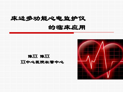 多功能心电监护仪的应用