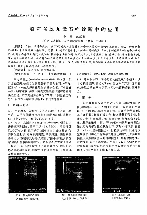 超声在睾丸微石症诊断中的应用