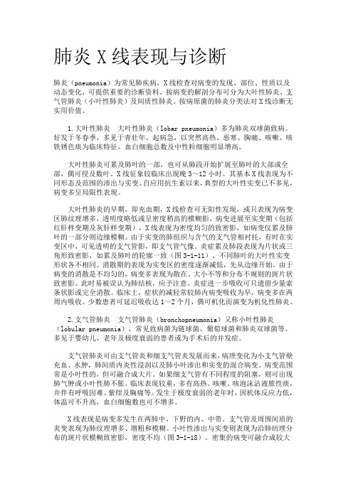 肺炎X线表现与诊断