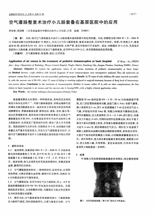 空气灌肠整复术治疗小儿肠套叠在基层医院中的应用