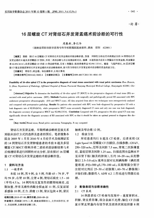 16层螺旋CT对肾结石并发肾盂癌术前诊断的可行性