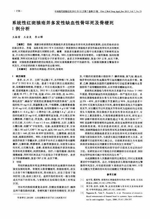 系统性红斑狼疮并多发性缺血性骨坏死及骨梗死1例分析