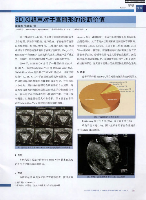 3D XI超声对子宫畸形的诊断价值