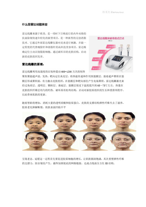 雷达线雕说明书