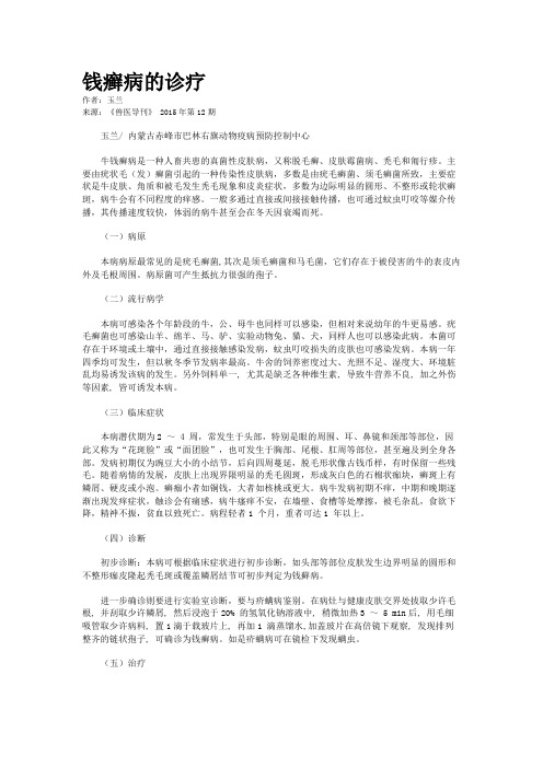 钱癣病的诊疗