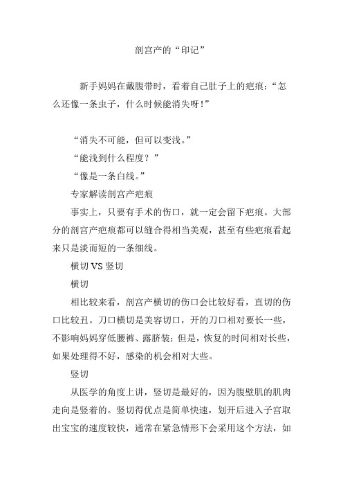 剖宫产的“印记”