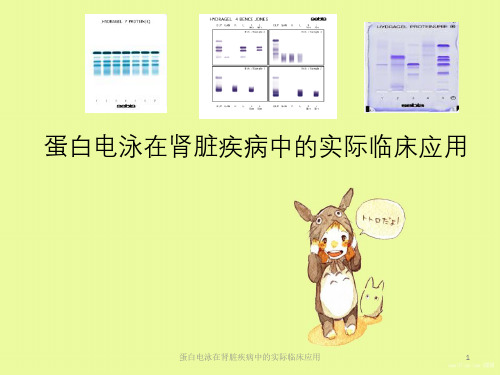 蛋白电泳在肾脏疾病中实际临床应用