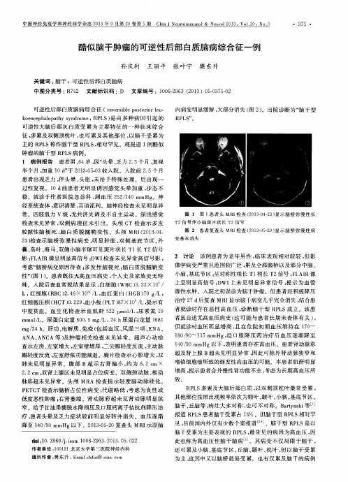 酷似脑干肿瘤的可逆性后部白质脑病综合征一例