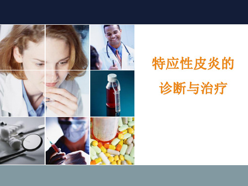 特应性皮炎的诊断与治疗