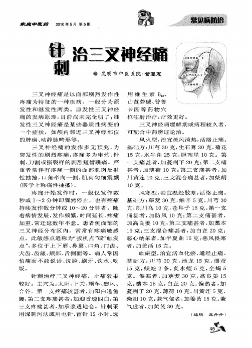 针刺治三叉神经痛