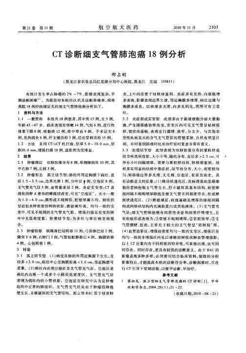 CT诊断细支气管肺泡癌18例分析