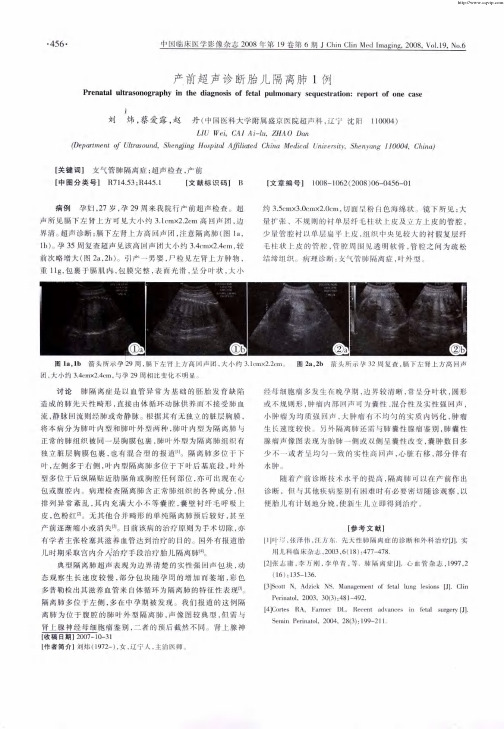 产前超声诊断胎儿隔离肺1例