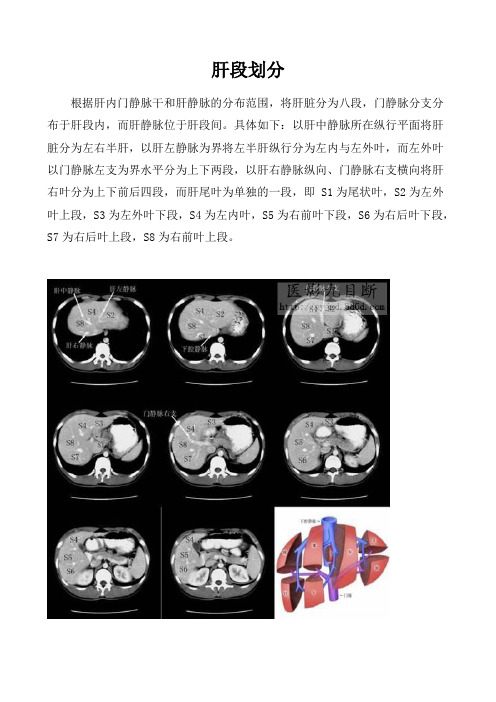 肝段划分