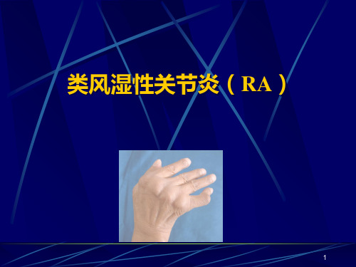 类风湿性关节炎本科教学PPT课件