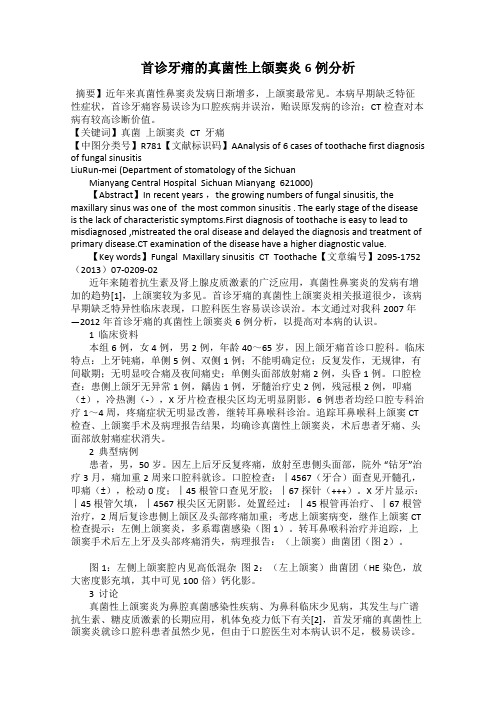 首诊牙痛的真菌性上颌窦炎6例分析