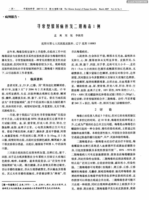 寻常型银屑病伴发二期梅毒1例