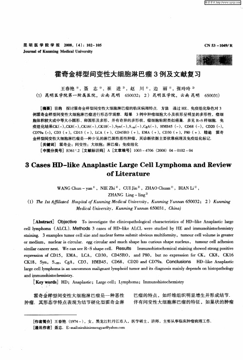 霍奇金样型间变性大细胞淋巴瘤3例及文献复习