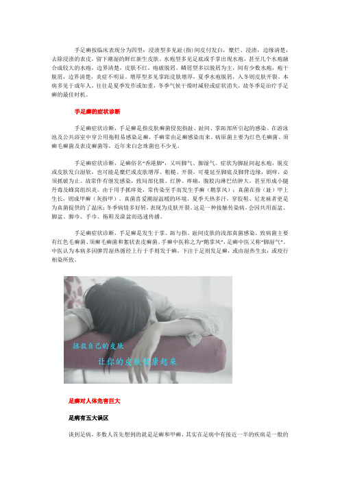 手足癣的症状