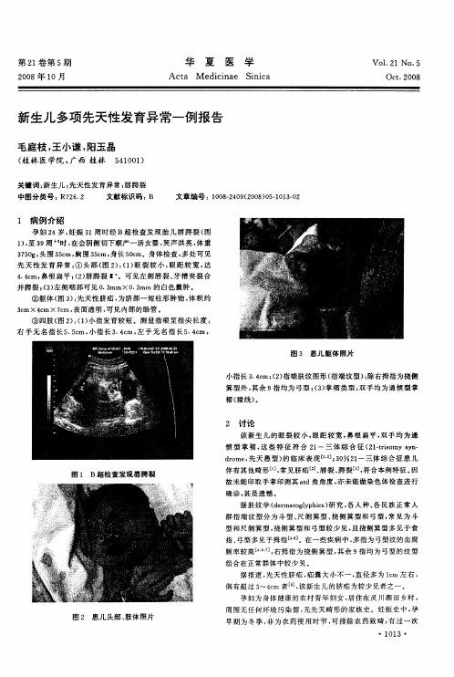 新生儿多项先天性发育异常一例报告