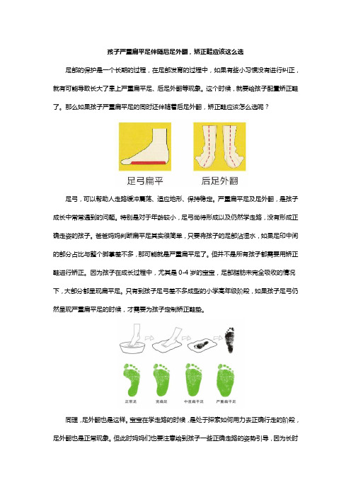 孩子严重扁平足伴随后足外翻,矫正鞋应该这么选