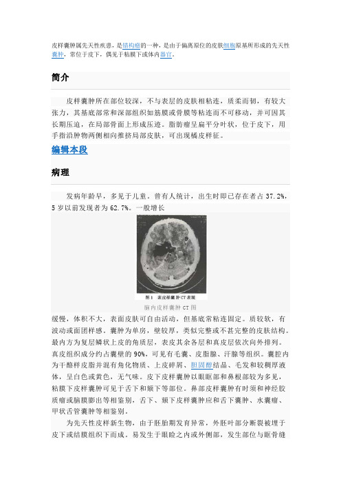 皮样囊肿