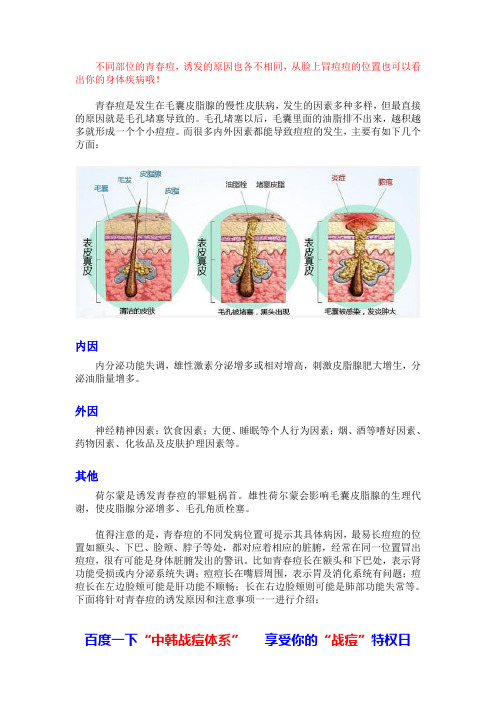 青春痘的位置与病因分析
