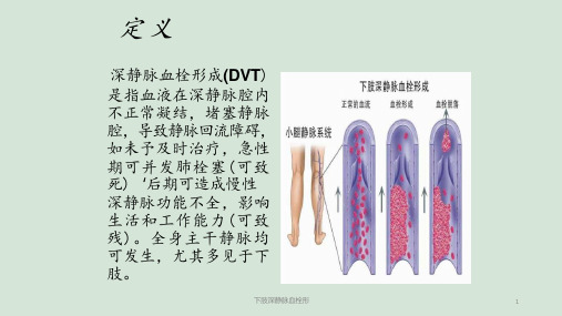 下肢深静脉血栓形ppt课件