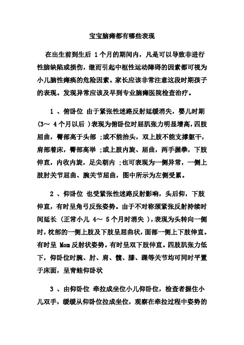 宝宝脑瘫都有哪些表现