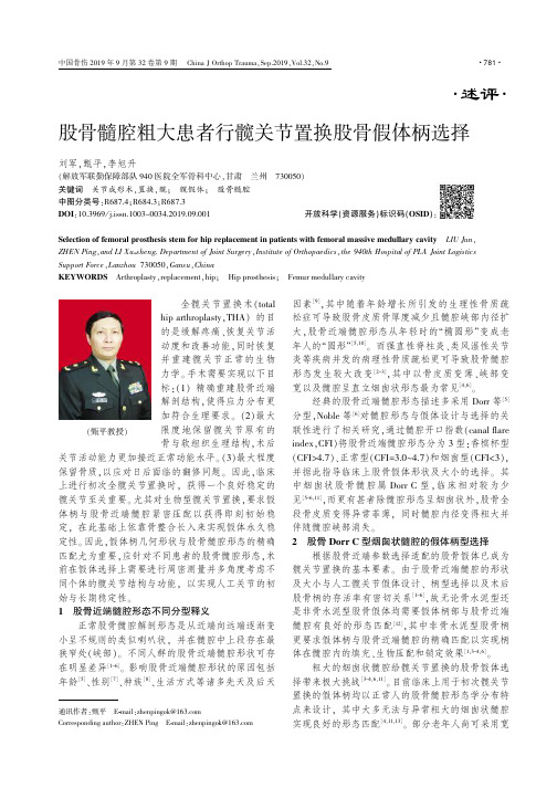 股骨髓腔粗大患者行髋关节置换股骨假体柄选择