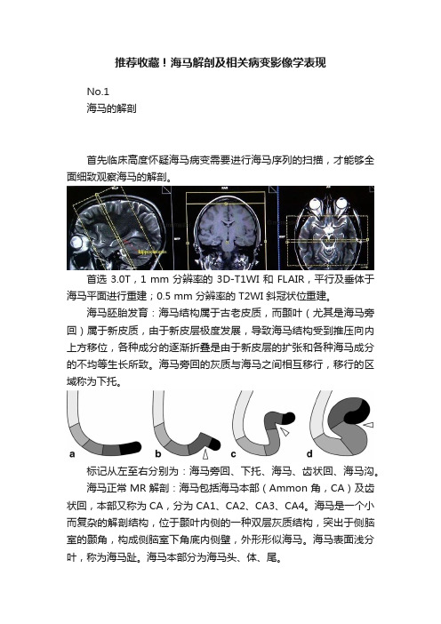 推荐收藏！海马解剖及相关病变影像学表现