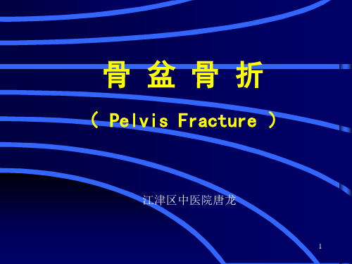 骨盆骨折ppt