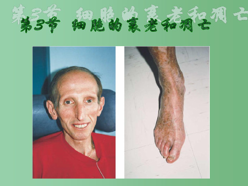 高一生物《细胞的衰老和凋亡、细胞的癌变》课件